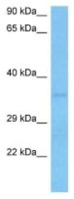 TRADD Rabbit anti-Human, Polyclonal, Novus Biologicals:Antibodies:Primary